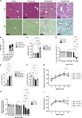 Impact of L-ornithine L-aspartate on non-alcoholic steatohepatitis-associated hyperammonemia and muscle alterations